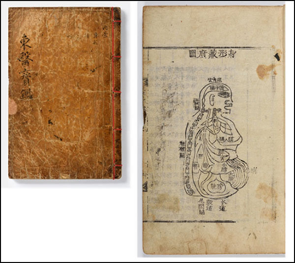 동의보감(東醫寶鑑) / 조선 후기(1613년 초간) / 국립중앙박물관 소장 / 36.7(세로)×22(가로)cm