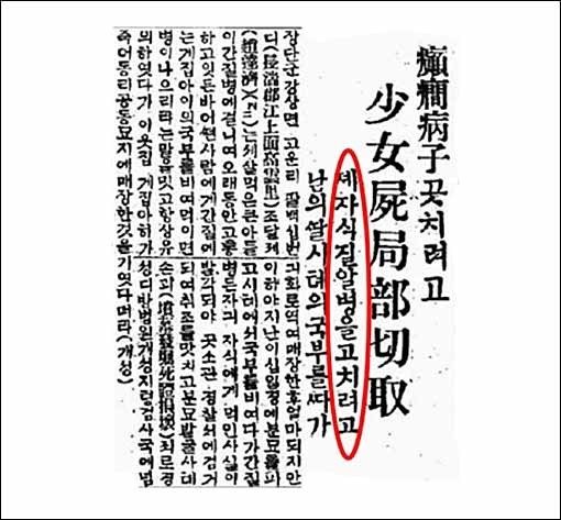 1926.11.28. 동아일보, 전간(癲癎) 곧 뗑깡을 질알별(지랄병)으로 쓰고 있다.