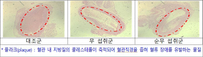 무의 혈관 내 플라크(plaque) 형성 억제 평가