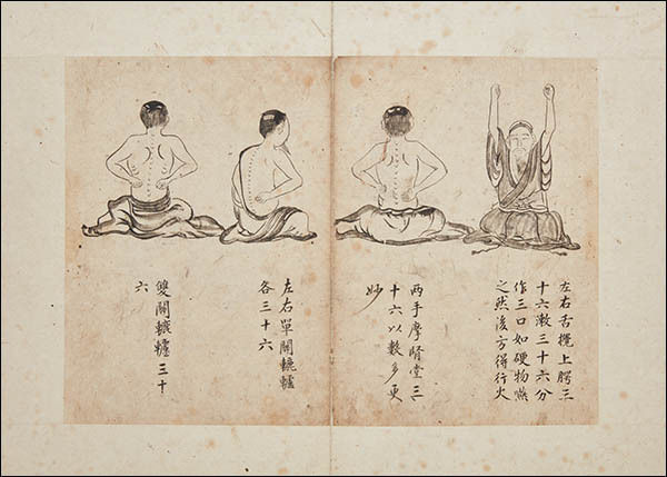 《선조유묵활인심방(先祖遺墨活人心方)》, 이황(李滉, 1501-1570), 조선 16세기, 필사본, 30.8×21.7cm, 한국국학진흥원, 도산서원 운영위원회