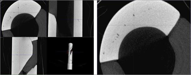 유리제 사리병 정밀 컴퓨터단층촬영(nano-CT) 사진