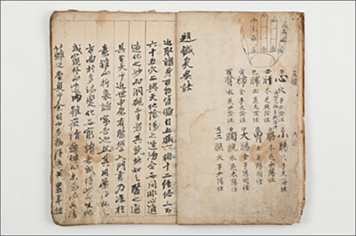 류성룡이 쓴 《침경요결(鍼經要訣)》
